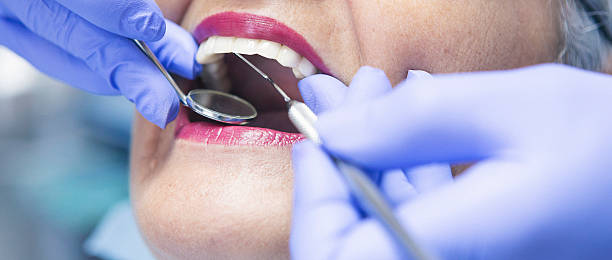 Best Emergency Dentist for Knocked-Out Tooth in Cortez, FL
